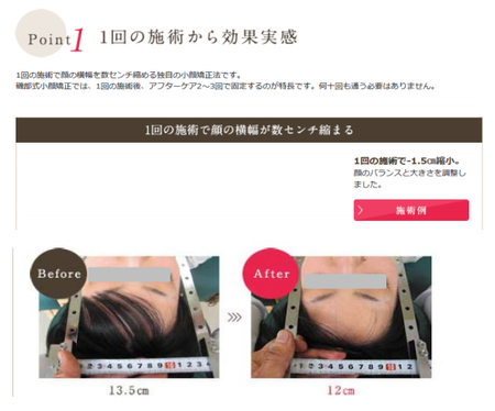 小顔.png